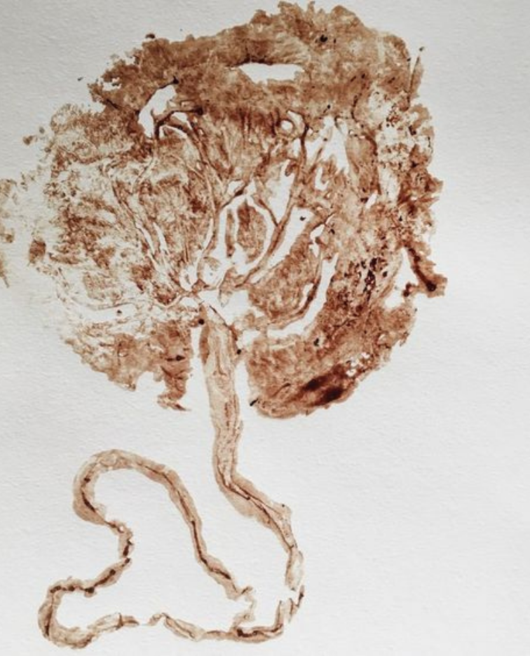 What Is the Placenta, and Why Do Certain Cultures Honor It?